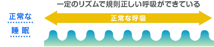 正常な睡眠といびきあるの睡眠